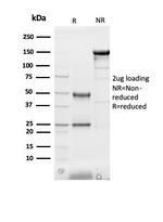 Heart Fatty Acid Binding Protein (H-FABP)/FABP3 Antibody in Immunoelectrophoresis (IE)