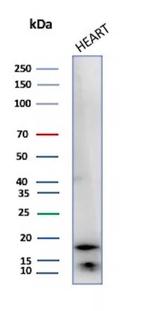 Heart Fatty Acid Binding Protein (H-FABP)/FABP3 Antibody in Western Blot (WB)
