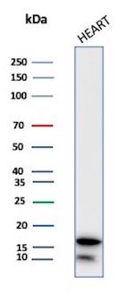 Heart Fatty Acid Binding Protein (H-FABP)/FABP3 Antibody in Western Blot (WB)