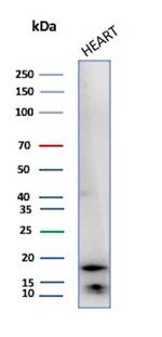 Heart Fatty Acid Binding Protein (H-FABP)/FABP3 Antibody in Western Blot (WB)