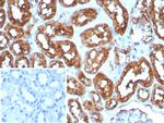 Heart Fatty Acid Binding Protein (H-FABP)/FABP3 Recombinant Rabbit Monoclonal Antibody (FABP3/8535R)