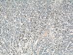 HLA-DRB5 Antibody in Immunohistochemistry (Paraffin) (IHC (P))