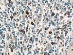 HLA-DRB5 Antibody in Immunohistochemistry (Paraffin) (IHC (P))