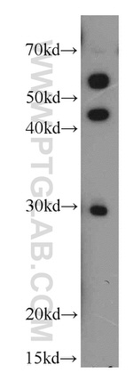HLA-DRB5 Antibody in Western Blot (WB)