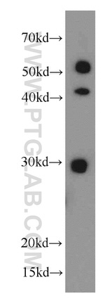 HLA-DRB5 Antibody in Western Blot (WB)