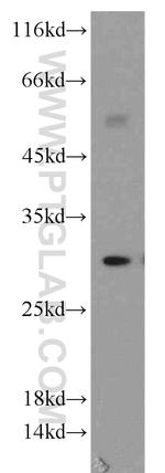 HLA-DRB5 Antibody in Western Blot (WB)