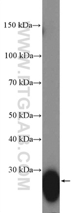 HLA-DRB5 Antibody in Western Blot (WB)