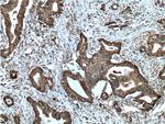 Integrin beta-6 Antibody in Immunohistochemistry (Paraffin) (IHC (P))