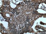 Integrin beta-6 Antibody in Immunohistochemistry (Paraffin) (IHC (P))