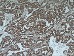 Integrin beta-6 Antibody in Immunohistochemistry (Paraffin) (IHC (P))