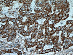 Integrin beta-6 Antibody in Immunohistochemistry (Paraffin) (IHC (P))