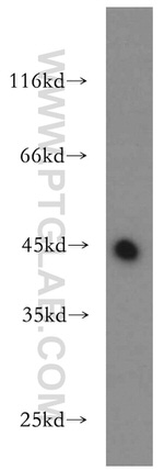 UQCRC1 Antibody in Western Blot (WB)