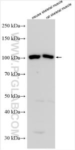 IGF1R Antibody in Western Blot (WB)