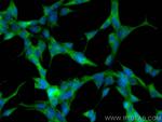 PI3 Kinase p110 Delta Antibody in Immunocytochemistry (ICC/IF)