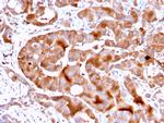 FABP5 Monoclonal Antibody (FABP5, 3750)