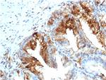 FABP5 (Marker of Metastatic Potential in Colorectal Cancer) Monoclonal Antibody (rFABP5/6354)