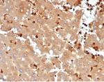FABP5 (Marker of Metastatic Potential in Colorectal Cancer) Recombinant Rabbit Monoclonal Antibody (FABP5/6353R)