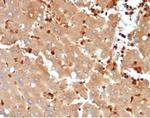 FABP5 (Marker of Metastatic Potential in Colorectal Cancer) Recombinant Rabbit Monoclonal Antibody (FABP5/6353R)