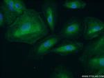 APAF1 Antibody in Immunocytochemistry (ICC/IF)