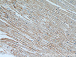APAF1 Antibody in Immunohistochemistry (Paraffin) (IHC (P))