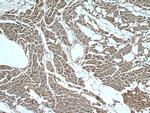 APAF1 Antibody in Immunohistochemistry (Paraffin) (IHC (P))