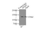 APAF1 Antibody in Immunoprecipitation (IP)