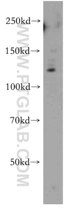 APAF1 Antibody in Western Blot (WB)