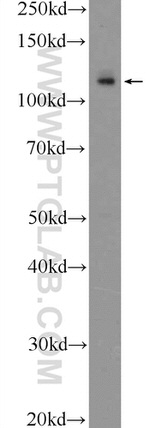 APAF1 Antibody in Western Blot (WB)