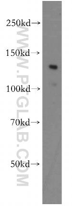 APAF1 Antibody in Western Blot (WB)