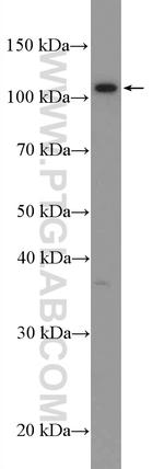 CACNA2D3 Antibody in Western Blot (WB)