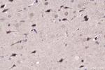 NFAT5 Antibody in Immunohistochemistry (Paraffin) (IHC (P))