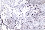 NFAT5 Antibody in Immunohistochemistry (Paraffin) (IHC (P))