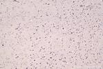 NFAT5 Antibody in Immunohistochemistry (Paraffin) (IHC (P))