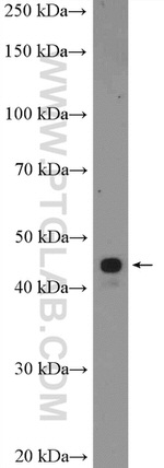 ZIC3 Antibody in Western Blot (WB)