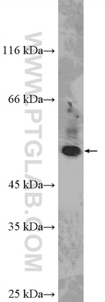 PFKFB1 Antibody in Western Blot (WB)
