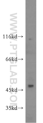 SERPINB10 Antibody in Western Blot (WB)