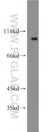 SERPINB10 Antibody in Western Blot (WB)