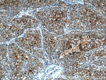 CYP2A6 Antibody in Immunohistochemistry (Paraffin) (IHC (P))