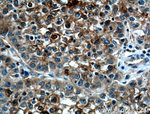 CYP2A6 Polyclonal Antibody