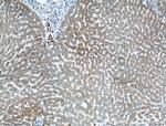 CYP2A6 Antibody in Immunohistochemistry (Paraffin) (IHC (P))