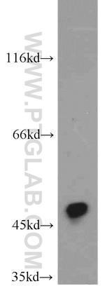 CYP2A6 Antibody in Western Blot (WB)