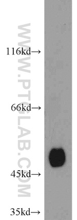 CYP2A6 Antibody in Western Blot (WB)