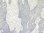 KRT2 Antibody in Immunohistochemistry (Paraffin) (IHC (P))