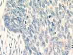 KRT2 Antibody in Immunohistochemistry (Paraffin) (IHC (P))
