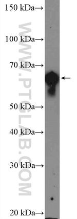 KRT2 Antibody in Western Blot (WB)