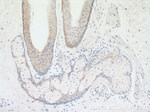 KRT2 Antibody in Immunohistochemistry (Paraffin) (IHC (P))