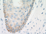KRT2 Antibody in Immunohistochemistry (Paraffin) (IHC (P))