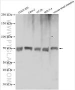 SLC15A1/PEPT1 Antibody in Western Blot (WB)
