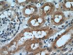 IDE Antibody in Immunohistochemistry (Paraffin) (IHC (P))