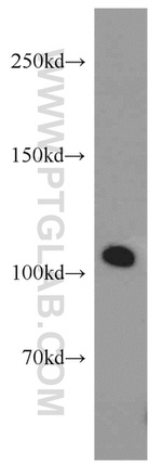 IDE Antibody in Western Blot (WB)